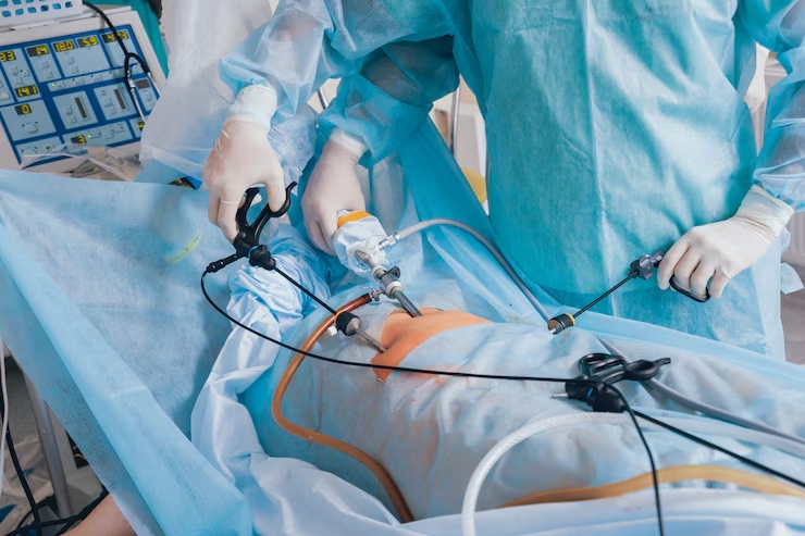 Laparoscopic _ Open Myomectomy (Fibroid Removal Surgery)---32