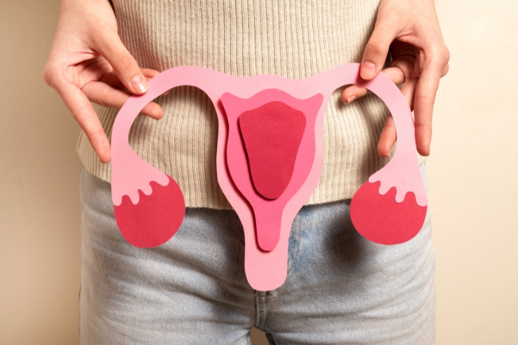 PCOS-----32